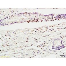Anti-ZNF144 antibody