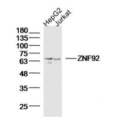 Anti-ZNF92 antibody