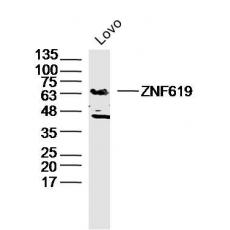 Anti-ZNF619 antibody