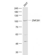 Anti-ZNF281 antibody