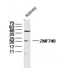 Anti-ZNF740 antibody