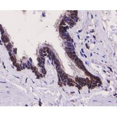 Anti-TLR7 antibody