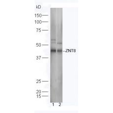 Anti-ZNT8 antibody