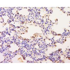 Anti-ZNF342 antibody