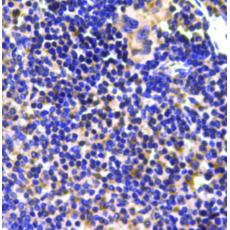 Anti-Ubiquitin antibody