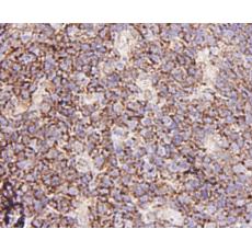 Anti-GRB2 antibody