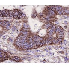 Anti-Integrin beta-1/CD29 antibody