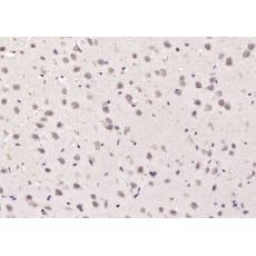 Anti-α-TAT antibody