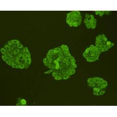 Anti-Ras antibody