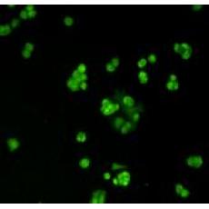 Anti-MGMT antibody