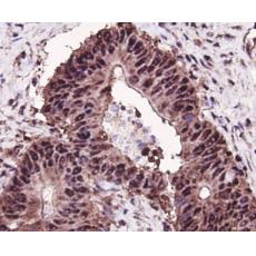 Anti-MSH6 antibody
