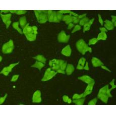 Anti-Topoisomerase II alpha antibody