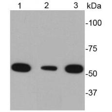 Anti-Desmin antibody