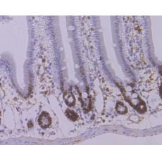 Anti-STAT6 antibody