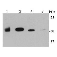 Anti-MMP1 antibody