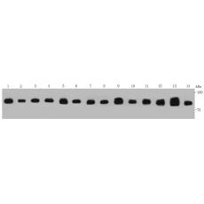 Anti-VCP antibody