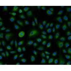 Anti-PDI antibody