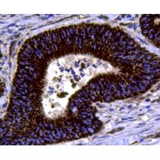 Anti-Chromogranin A antibody