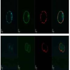 Anti-MATER antibody