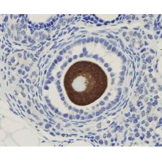 Anti-OOEP antibody