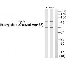 Anti-Cleaved-C1r HC (R463) antibody