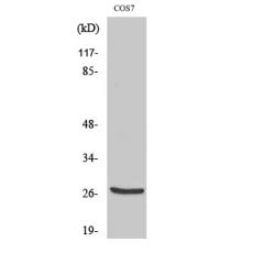 Anti-Cleaved-Cathepsin Z (L62) antibody