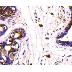 Anti-HSP70 antibody