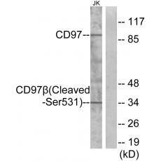 Anti-Cleaved-CD97β (S531) antibody