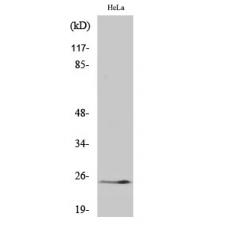 Anti-Cleaved-KLK11 (I54) antibody