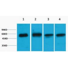 Anti-Akt3 antibody