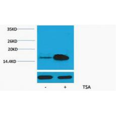 Anti-Histone H2A (Acetyl Lys5) antibody