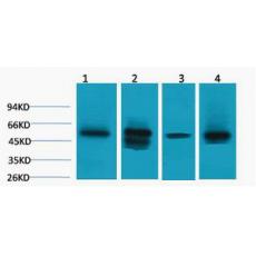 Anti-LDHD antibody