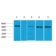 Anti-ZBTB45 antibody