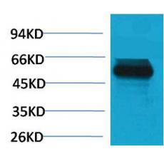 Anti-TRIM72 antibody