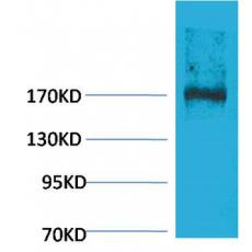 Anti-EPG5 antibody