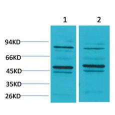 Anti-BEST2 antibody