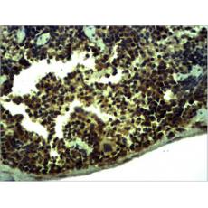 Anti-TLR1 antibody