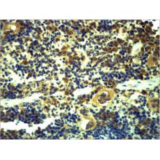 Anti-TLR6 antibody