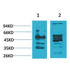 Anti-NMBR antibody