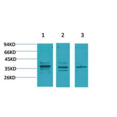 Anti-CACNG2 antibody
