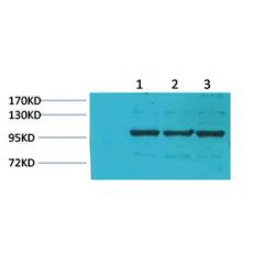 Anti-IGFN1 antibody