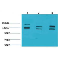 Anti-BAI1 antibody