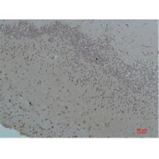 Anti-Bestrophin-1 antibody