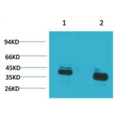 Anti-CABP antibody