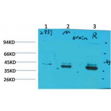 Anti-CABP2 antibody