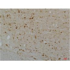 Anti-Cav1.3 antibody