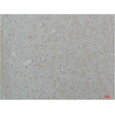 Anti-Cav2.2 antibody