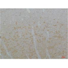 Anti-Cav3.3 antibody