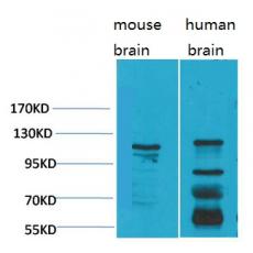 Anti-CaVα2δ3 antibody