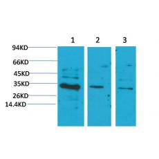 Anti-CNTF antibody